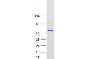 Testis Expressed 264 (TEX264) (Transcript Variant 1) protein (Myc-DYKDDDDK Tag)