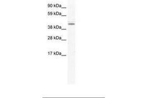 Image no. 1 for anti-DEAD (Asp-Glu-Ala-Asp) Box Polypeptide 49 (DDX49) (AA 81-130) antibody (ABIN202639) (DDX49 antibody  (AA 81-130))