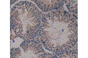 Used in DAB staining on fromalin fixed paraffin- embedded Kidney tissue (DHPS antibody  (AA 1-369))