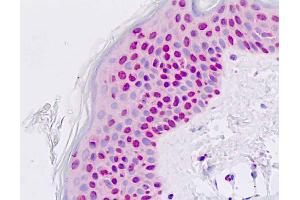 Anti-PAX7 antibody IHC staining of human skin, epidermis. (PAX7 antibody  (AA 410-437))