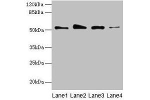 Western blot All lanes: GSDMD antibody at 4 μg/mL Lane 1: Jurkat whole cell lysate Lane 2: Hela whole cell lysate Lane 3: A431 whole cell lysate Lane 4: U251 whole cell lysate Secondary Goat polyclonal to rabbit IgG at 1/10000 dilution Predicted band size: 53 kDa Observed band size: 53 kDa (GSDMD antibody  (AA 1-256))