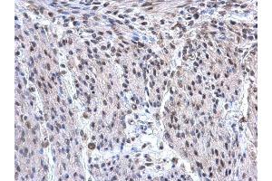 IHC-P Image hnRNP F antibody [N1N3] detects hnRNP F protein at nucleus on mouse uterus by immunohistochemical analysis. (HNRNPF antibody)