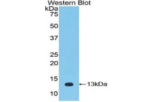 WB of Protein Standard: different control antibodies against Highly purified E. (IL-33 ELISA Kit)