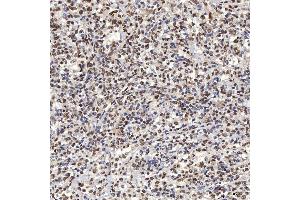 IHC analysis of U1A/SNRPA using anti-U1A/SNRPA antibody (ABIN7600891). (SNRPA1 antibody  (AA 25-218))