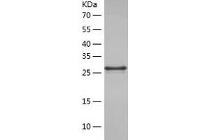 Western Blotting (WB) image for Macrophage Inflammatory Protein Related Protein 1 (MRP1) (AA 1248-1531) protein (His tag) (ABIN7123821)