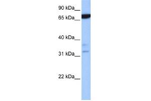 WB Suggested Anti-ZBTB46 Antibody Titration:  0. (ZBTB46 antibody  (N-Term))