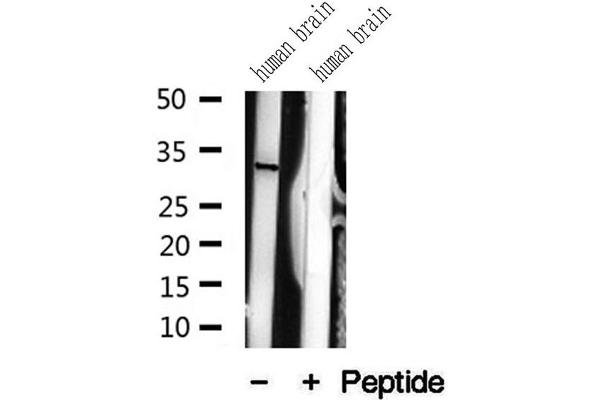 MFF antibody  (Internal Region)
