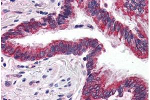 Human Lung (formalin-fixed, paraffin-embedded) stained with GRIK1 antibody ABIN343897 at 5 ug/ml followed by biotinylated goat anti-rabbit IgG secondary antibody ABIN481713, alkaline phosphatase-streptavidin and chromogen. (GRIK1 antibody  (C-Term))