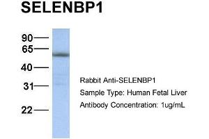 WB Suggested Anti-SELENBP1 antibody Titration: 1 ug/mL Sample Type: Human liver (SELENBP1 antibody  (N-Term))