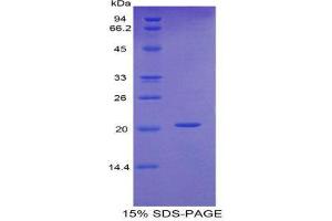 SDS-PAGE (SDS) image for Fibrillin 1 (FBN1) (AA 723-902) protein (His tag) (ABIN2121027) (Fibrillin 1 Protein (FBN1) (AA 723-902) (His tag))