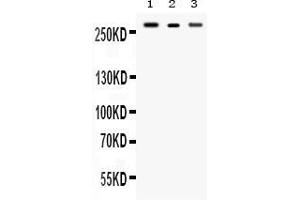 Western blot analysis of Talin 2 expression in rat brain extract ( Lane 1), mouse cardiac muscle extract ( Lane 2) and SMMC7721 whole cell lysates ( Lane 3). (TLN2 antibody  (Middle Region))