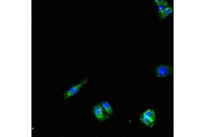 Immunofluorescent analysis of HepG2 cells using ABIN7162688 at dilution of 1:100 and Alexa Fluor 488-congugated AffiniPure Goat Anti-Rabbit IgG(H+L) (PNPLA1 antibody  (AA 101-300))