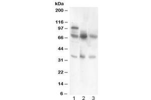 Western blot testing of GAD67 antibody and Lane 1:  rat brain (GAD antibody  (AA 14-122))