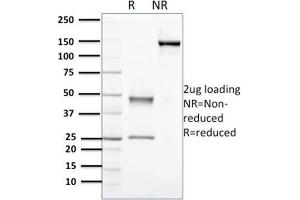 Purified Nucleophosmin-Monospecific Mouse Monoclonal Antibody (NPM1/3398).