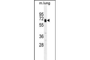 GPC3 Antibody? (Glypican 3 antibody  (C-Term))