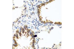 Immunohistochemistry of paraffin-embedded rat lung using C8orf4 antibody at dilution of 1:100 (40x lens). (C8orf4 antibody)