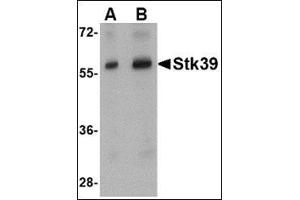 Western blot analysis of Stk39 in rat brain tissue lysate with this product at (A) 1 and (B) 2 μg/ml.