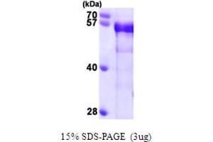 SDS-PAGE (SDS) image for Bridging Integrator 1 (BIN1) (AA 1-439) protein (His tag) (ABIN667182) (BIN1 Protein (AA 1-439) (His tag))