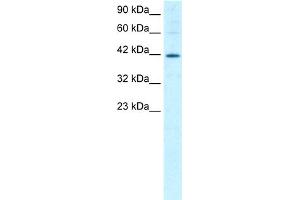 WB Suggested Anti-MIER1 Antibody Titration:  1. (MIER1 antibody  (Middle Region))