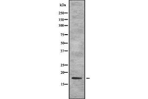 Western blot analysis of TSLP using Jurkat whole cell lysates (Thymic Stromal Lymphopoietin antibody  (Internal Region))
