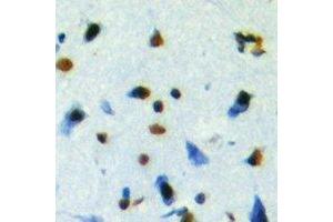 Immunohistochemistry (IHC) image for anti-NUDC antibody (ABIN7308104) (NUDC antibody)