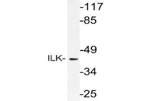 Western blot (WB) analysis of ILK antibody in extracts from rat liver cells. (ILK antibody)