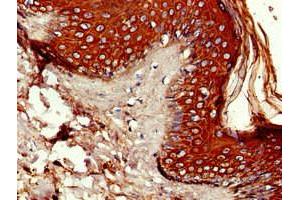 IHC analysis of paraffin-embedded human skin tissue, using P4HA1 antibody (1/100 dilution). (P4HA1 antibody  (AA 256-525))