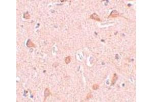 Immunohistochemical staining of human brain tissue with 5 ug/mL SIPA1L1 polyclonal antibody . (SIPA1L1 antibody  (N-Term))