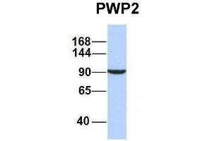 Host:  Rabbit  Target Name:  PWP2  Sample Type:  MCF7  Antibody Dilution:  1. (PWP2 antibody  (Middle Region))