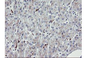 Immunohistochemical staining of paraffin-embedded Human liver tissue using anti-NRIP3 mouse monoclonal antibody. (NRIP3 antibody)