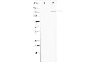 Western blot analysis of PPAR-BP phosphorylation expression in Serum treated HuvEc whole cell lysates,The lane on the left is treated with the antigen-specific peptide. (MED1 antibody  (pThr1457))