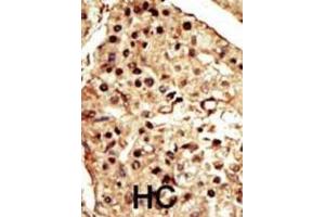 Immunohistochemistry (IHC) image for anti-Transient Receptor Potential Cation Channel, Subfamily M, Member 7 (TRPM7) antibody (ABIN2995271) (TRPM7 antibody)