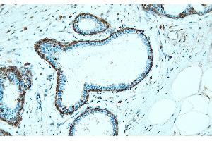 Immunohistochemistry (IHC) image for anti-Annexin A1 (ANXA1) (AA 149-166), (Internal Region) antibody (ABIN7598902) (Annexin a1 antibody  (Internal Region))