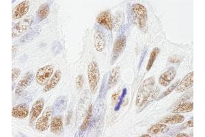 Immunohistochemistry (IHC) image for anti-Nuclear Mitotic Apparatus Protein 1 (NUMA1) (AA 900-950) antibody (ABIN7448994)