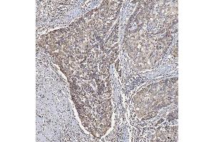 IHC analysis of ACAD9 using anti-ACAD9 antibody (ABIN7602670). (ACAD9 antibody  (AA 92-621))