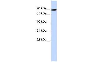 PGM2L1 antibody used at 1 ug/ml to detect target protein. (PGM2L1 antibody  (N-Term))