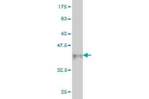 TNKS antibody  (AA 1017-1124)