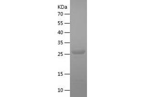 Western Blotting (WB) image for GID Complex Subunit 8 Homolog (GID8) (AA 1-228) protein (His tag) (ABIN7283616) (GID8/C20orf11 Protein (AA 1-228) (His tag))