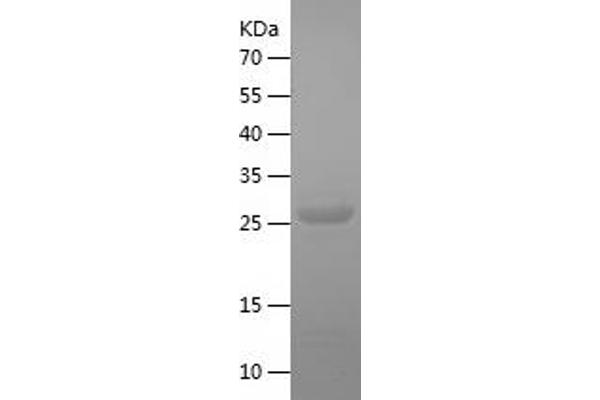 GID8/C20orf11 Protein (AA 1-228) (His tag)