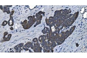 IHC analysis of MAP4K5 using anti-MAP4K5 antibody (ABIN7603181). (MAP4K5 antibody  (N-Term))