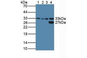Figure. (CDK2 antibody  (AA 94-198))