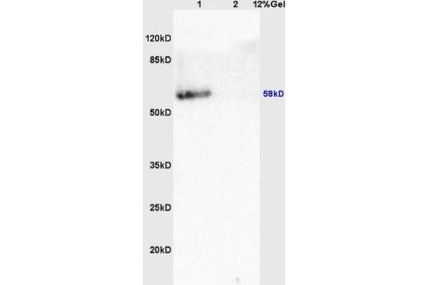 VAT1 antibody  (AA 421-525)