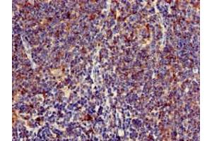 Immunohistochemistry of paraffin-embedded human lymph node tissue using ABIN7158646 at dilution of 1:100 (BC055111 antibody  (AA 1-418))