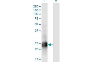 Western Blot analysis of MID1IP1 expression in transfected 293T cell line by MID1IP1 monoclonal antibody (M01), clone 8G8. (m1ip1 antibody  (AA 1-183))