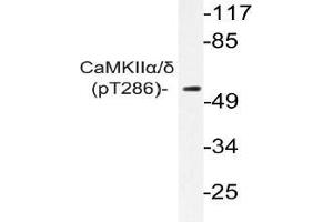 Western blot (WB) analyzes of p-CaMKIIalpha/delta antibody in extracts from K562 cells.