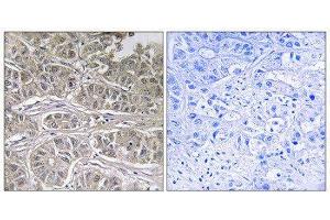 Immunohistochemistry (IHC) image for anti-Solute Carrier Family 25 (Mitochondrial Oxodicarboxylate Carrier), Member 21 (Slc25a21) (Internal Region) antibody (ABIN1851571) (SLC25A21 antibody  (Internal Region))