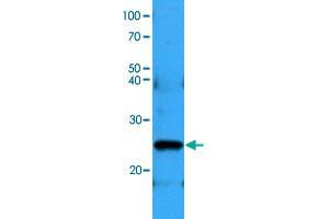 Western blot analysis of NIH/3T3 cell lysates (35 ug) with BCL2 monoclonal antibody, clone AT1B5  at 1 : 500 dilution. (Bcl-2 antibody  (AA 1-211))