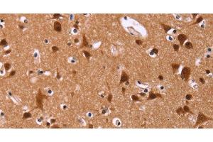 Immunohistochemistry of paraffin-embedded Human brain tissue using ART5 Polyclonal Antibody at dilution 1:50 (ART5 antibody)