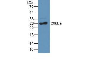 Detection of Recombinant GSTa3, Mouse using Polyclonal Antibody to Glutathione S Transferase Alpha 3 (GSTa3) (GSTA3 antibody  (AA 1-221))
