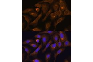 Immunohistochemistry of paraffin-embedded mouse kidney using SHMT1 antibody (ABIN6132654, ABIN6147744, ABIN6147746 and ABIN6216135) at dilution of 1:100 (40x lens). (SHMT1 antibody  (AA 285-444))